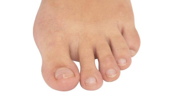 Ingrown Toenail Treatment In Pune Dr Chetan Oswal