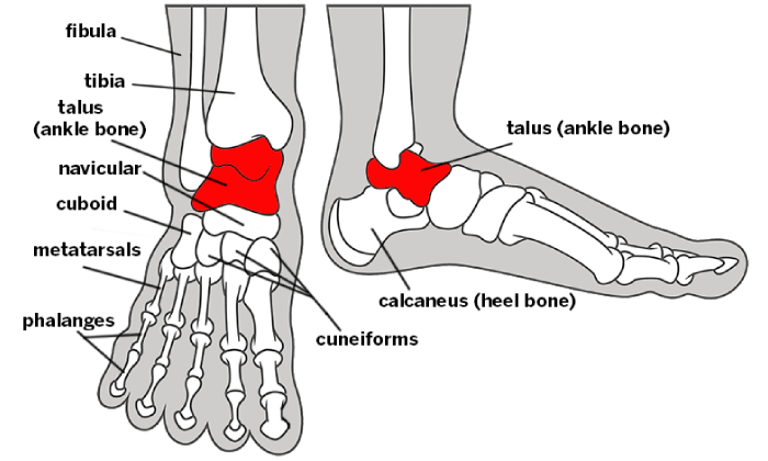 Osteochondral Lesion of Talus Treatment Pune, Pimpri Chinchwad PCMC