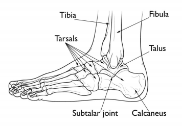 Calcaneus Fracture Treatment in Pune