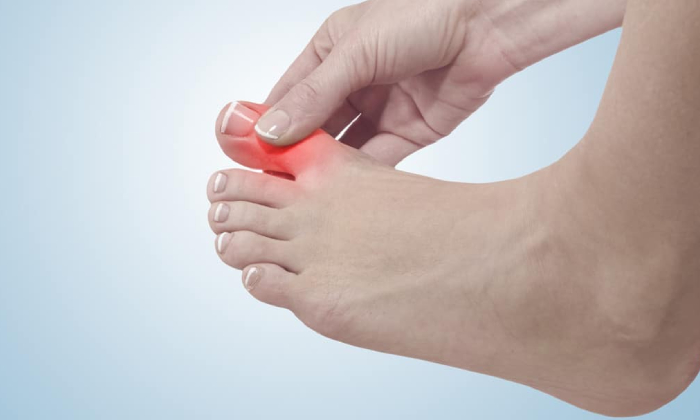 Great Toe Arthritis Treatment in Pune, Pimpri Chinchwad PCMC | Orthowin Foot & Ankle Clinic | Dr. Chetan Oswal