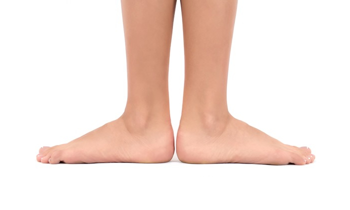 Flexible Flatfoot Needs Adjustable Treatment Methods - Wheat Ridge, CO &  Arvada, CO: Rocky Mountain Foot & Ankle Center