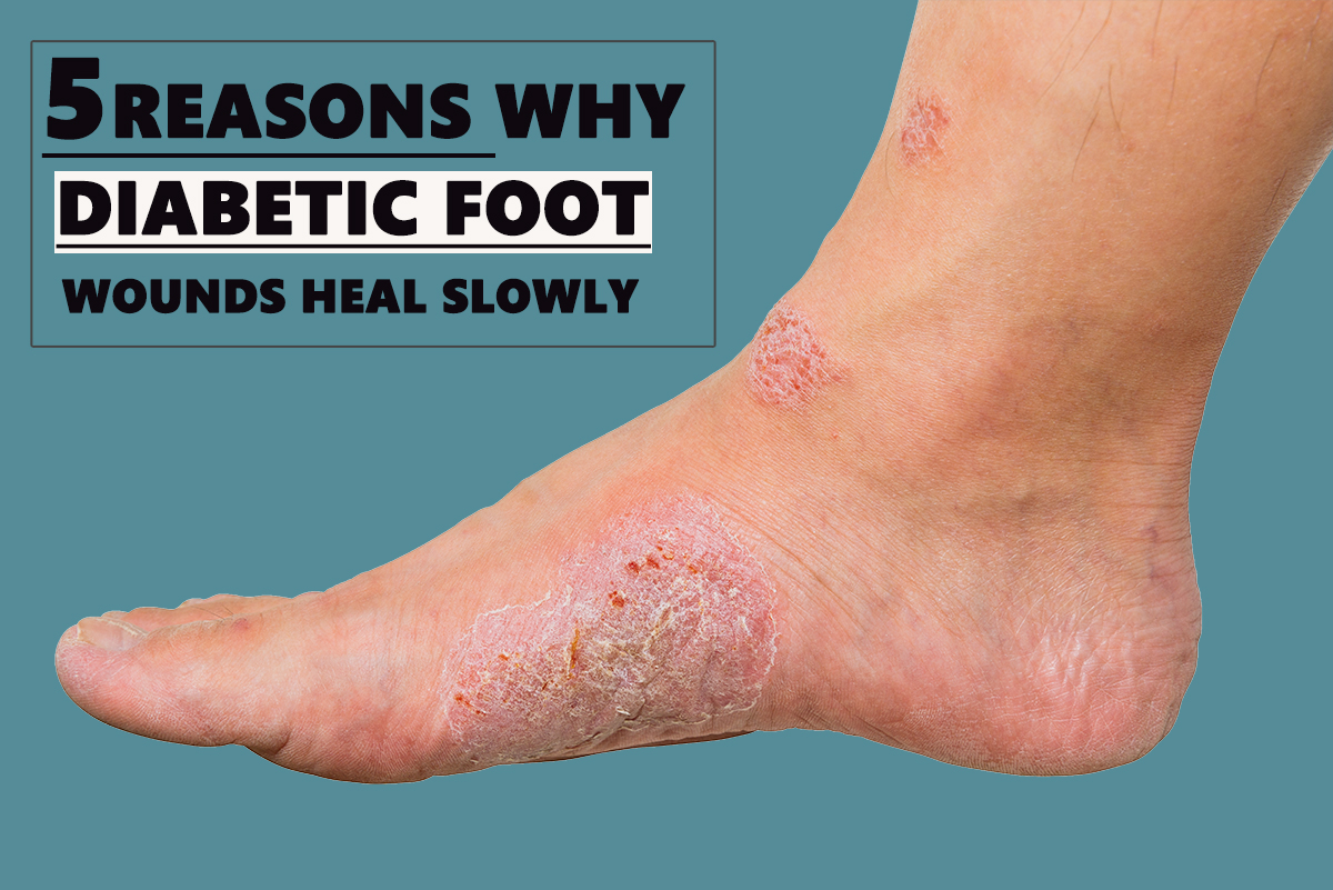 5 Reasons Why Diabetic Foot Wounds Heal Slowly | Dr. Chetan Oswal | Orthowin Foot & Ankle Clinic Pune