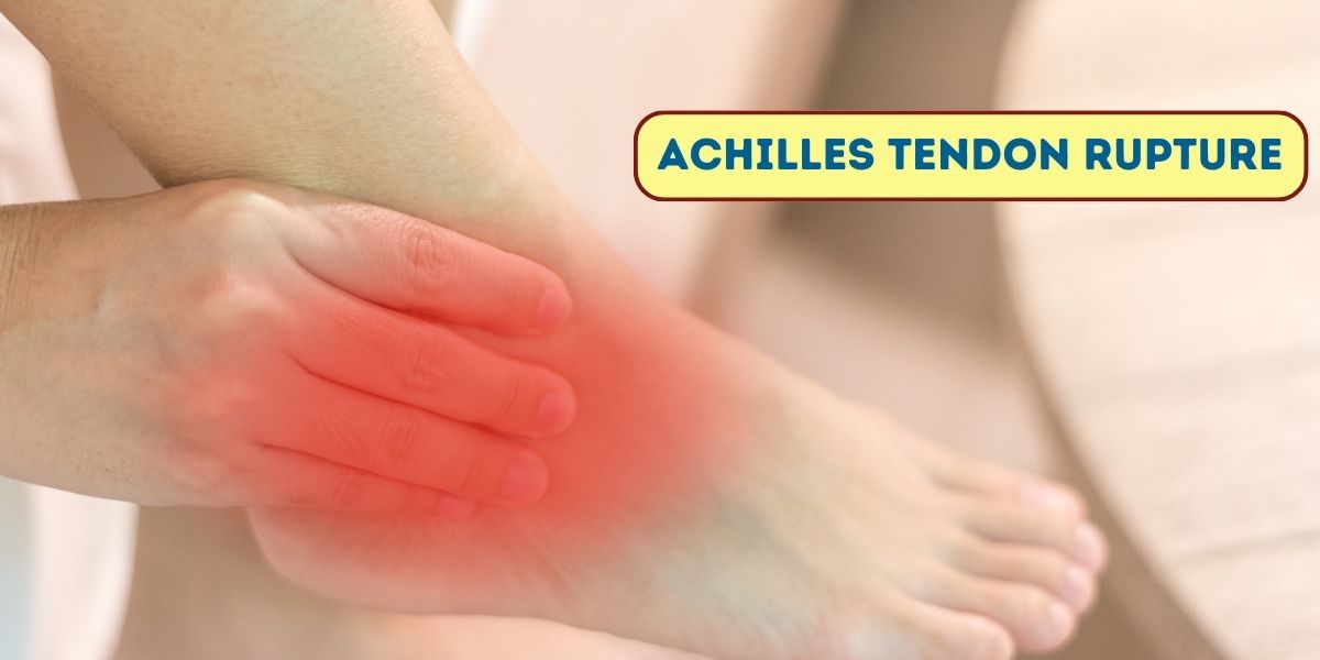 Achilles tendon rupture