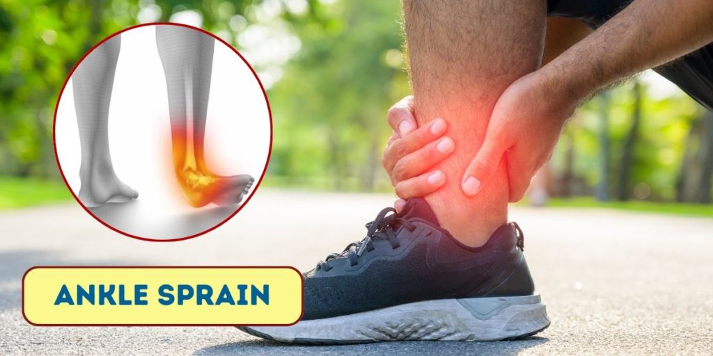 Ankle Sprain treatment in hindi