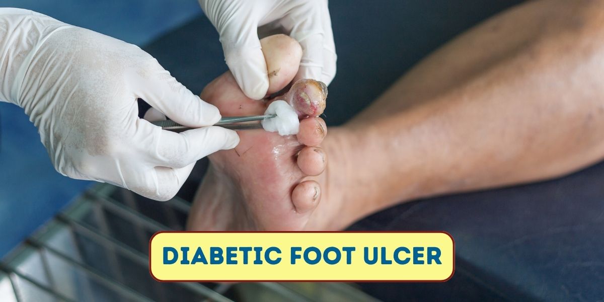 Diabetic Foot Ulcer