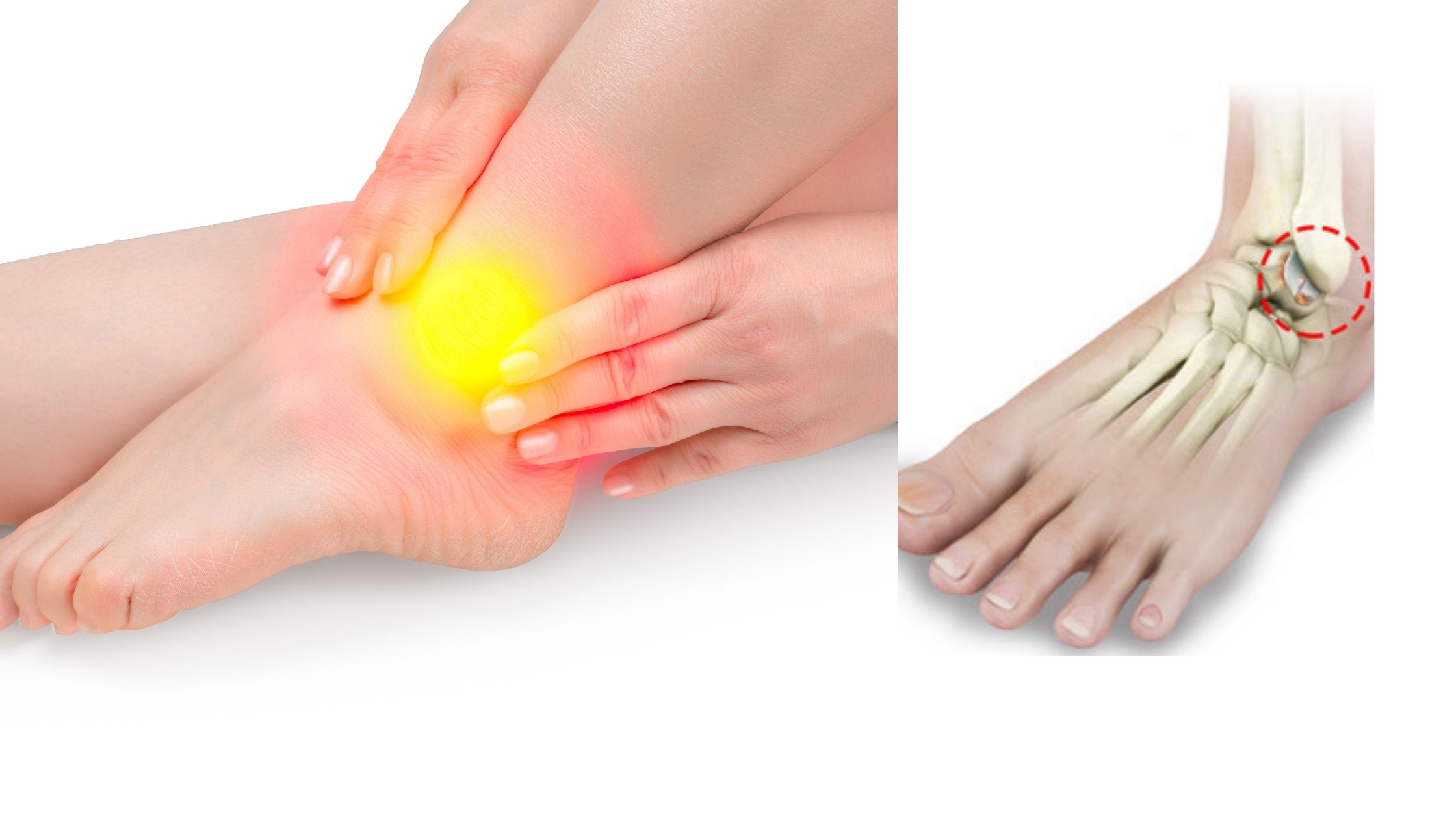 foot and ankle treatment in pune
