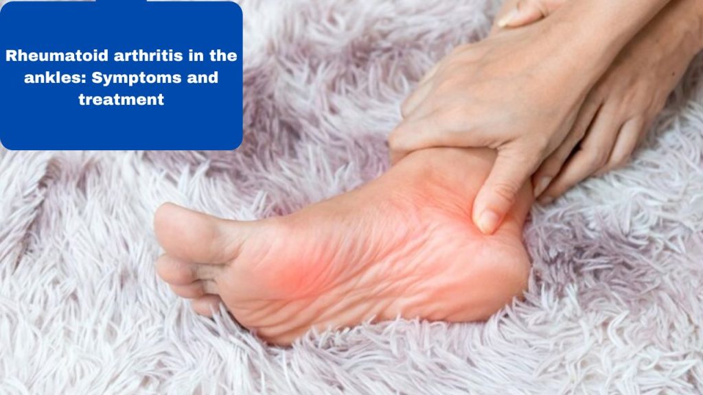 Rheumatoid arthritis in the ankles: Symptoms and treatment