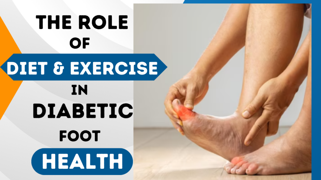 Diet and exercise for diabetic foot