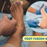 Foot fusion surgery