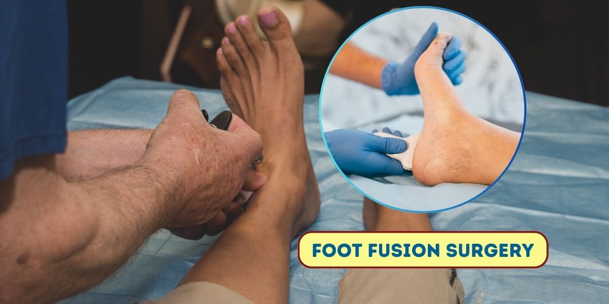 Foot fusion surgery