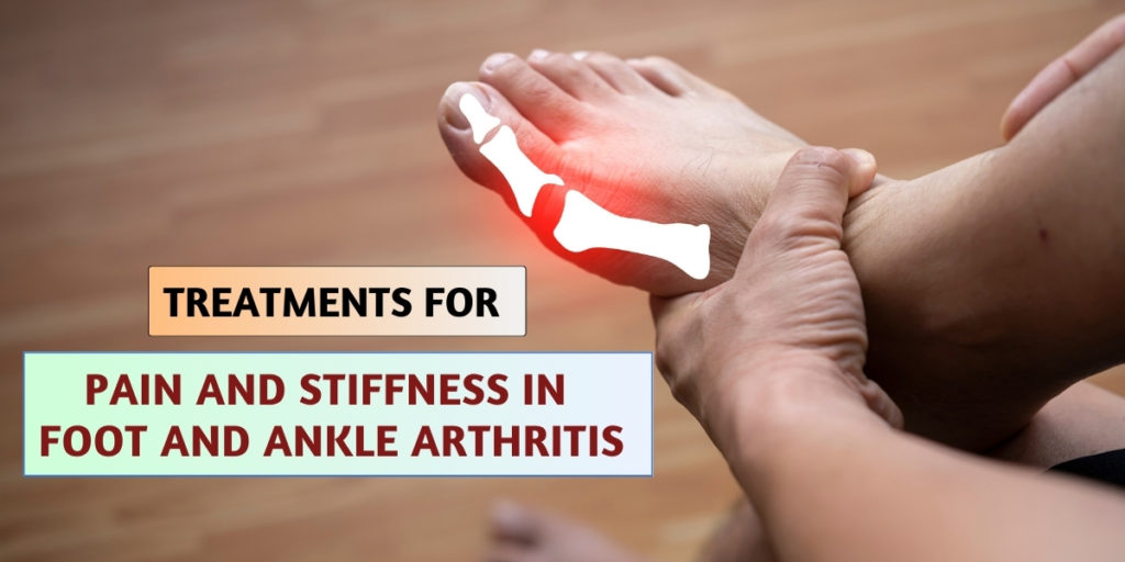 Pain and Stiffness in Foot and Ankle Arthritis