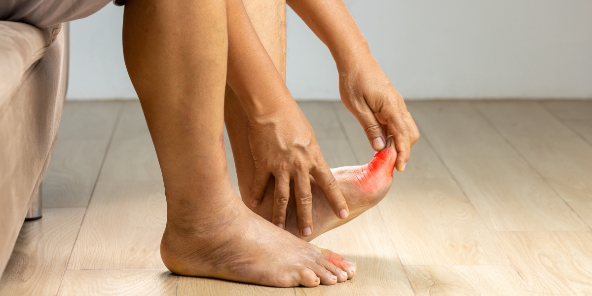 Foot And Ankle Arthritis