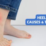 Heel Pain Treatment