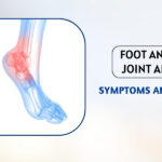 Foot and Ankle Joint Arthritis