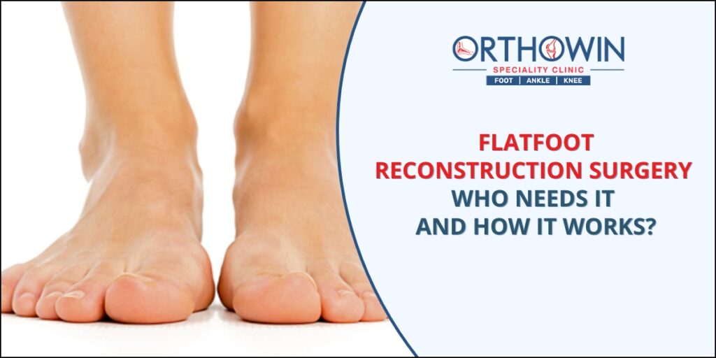 Flatfoot surgery