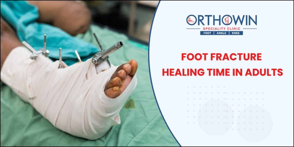 Foot Fracture