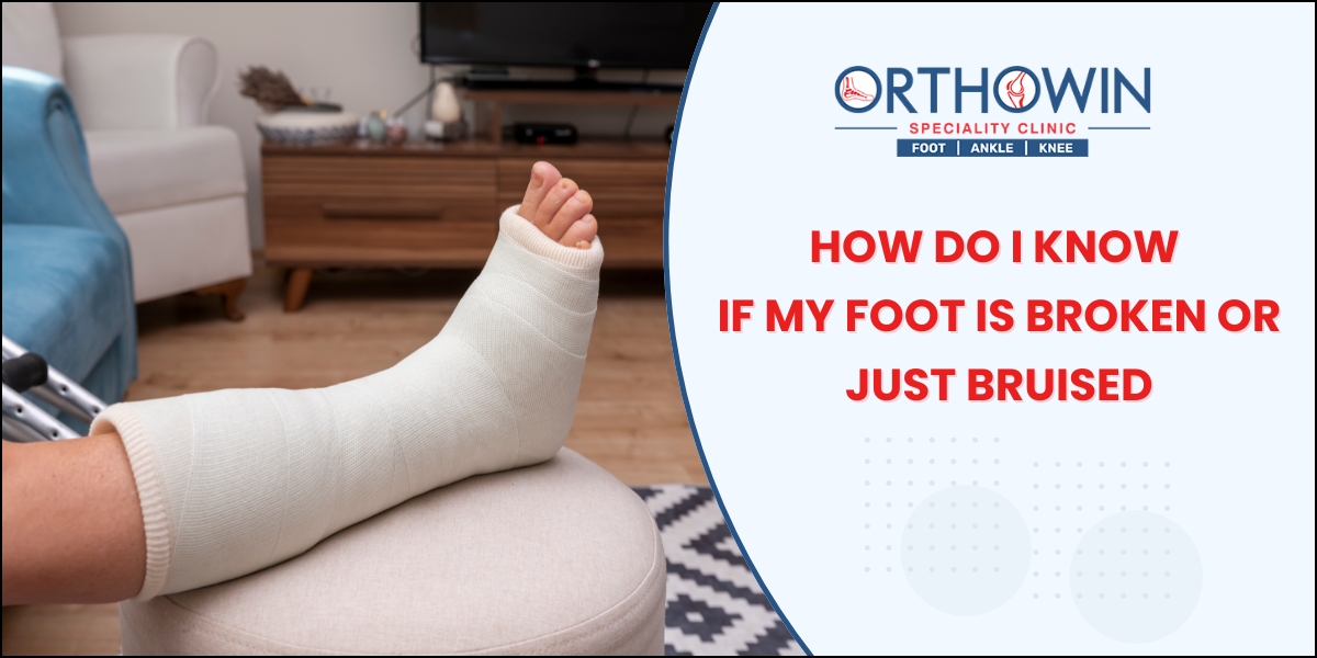 Broken Foot