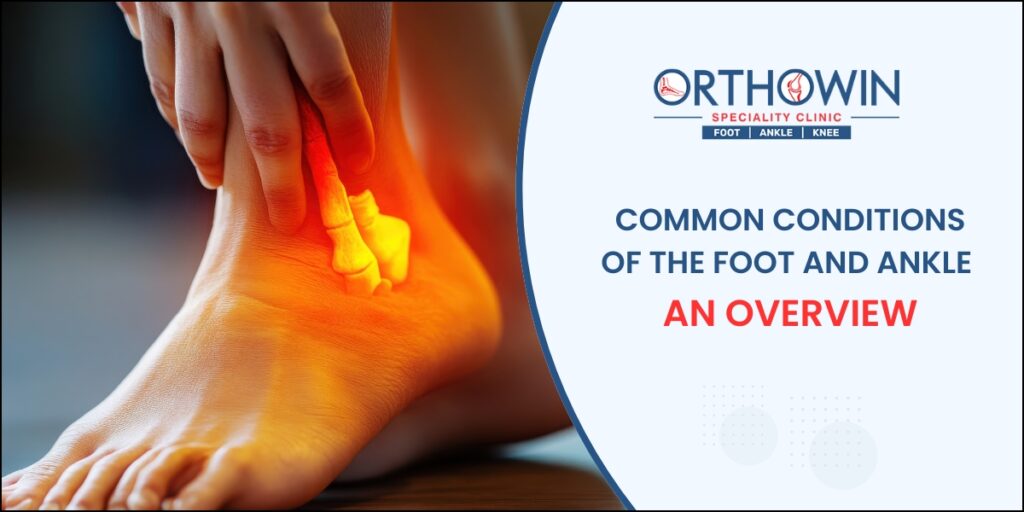 Common Conditions of the Foot and Ankle