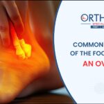 Common Conditions of the Foot and Ankle
