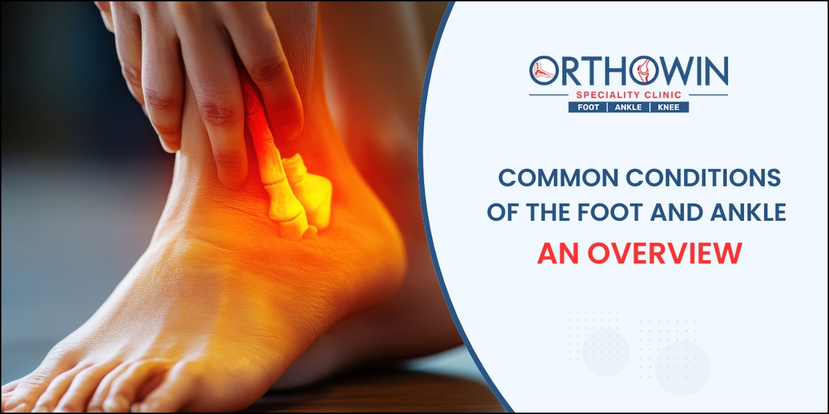 Common Conditions of the Foot and Ankle