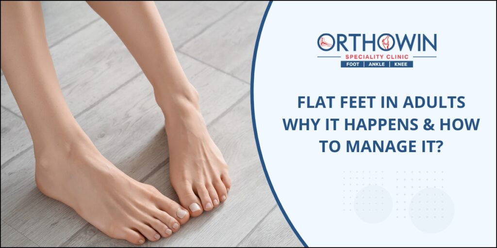Flat Feet in adults