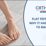 Flat Feet in adults
