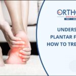Plantar Fasciitis