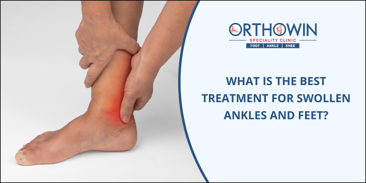 Swollen Feet and ankle treatment