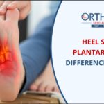 Difference between heel spur and Plantar fasciitis