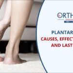 Plantar Fasciitis: Top Causes, Effective Stretches, and Lasting Relief