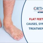 Flat feet treatment in Pune