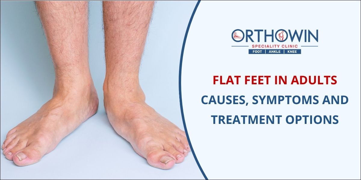 Flat feet treatment in Pune